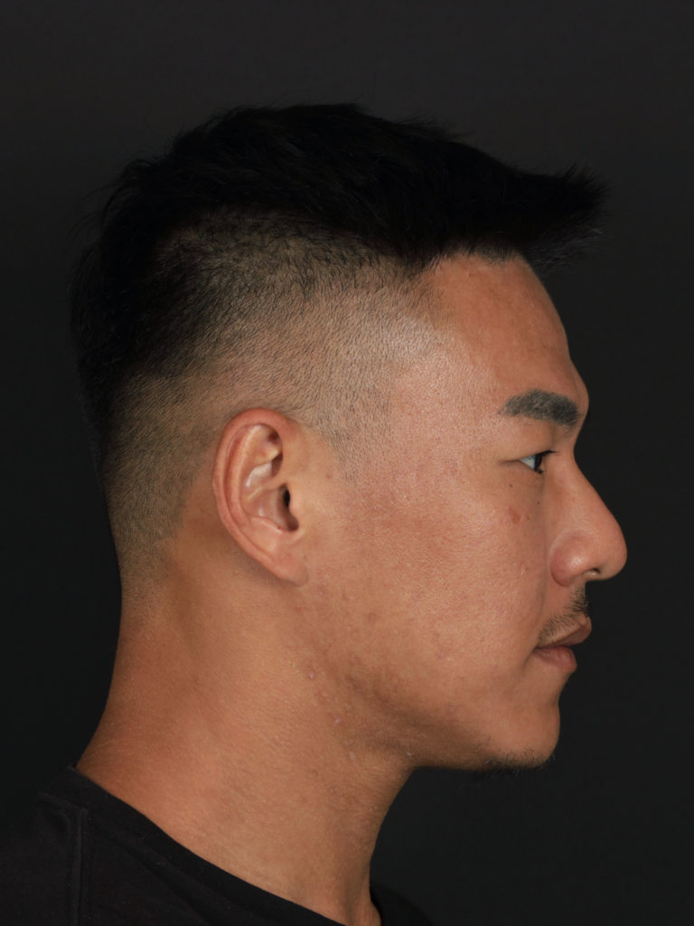 BA_舒顏萃_張家瑜_side_before_small