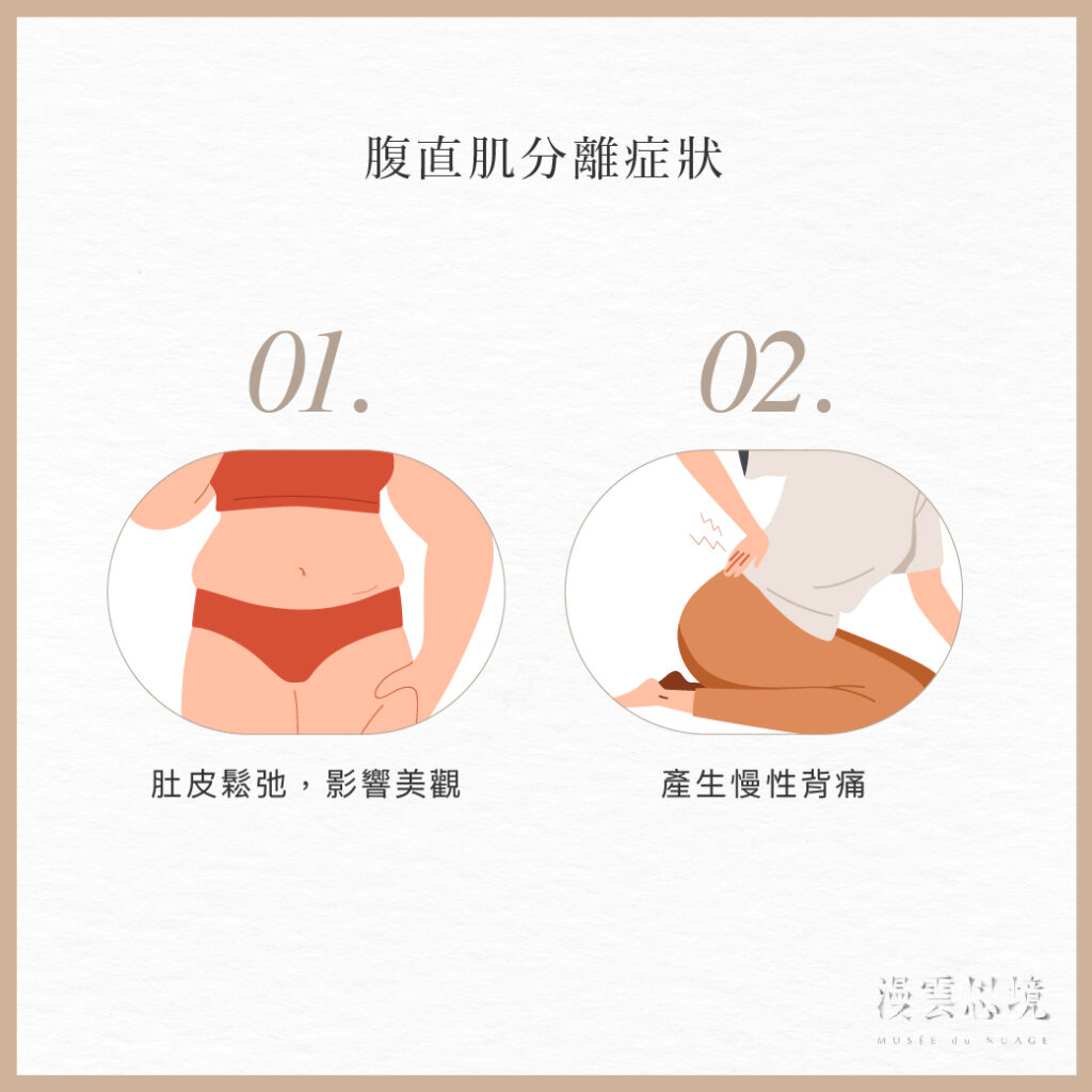 腹直肌分離會有哪些狀況？