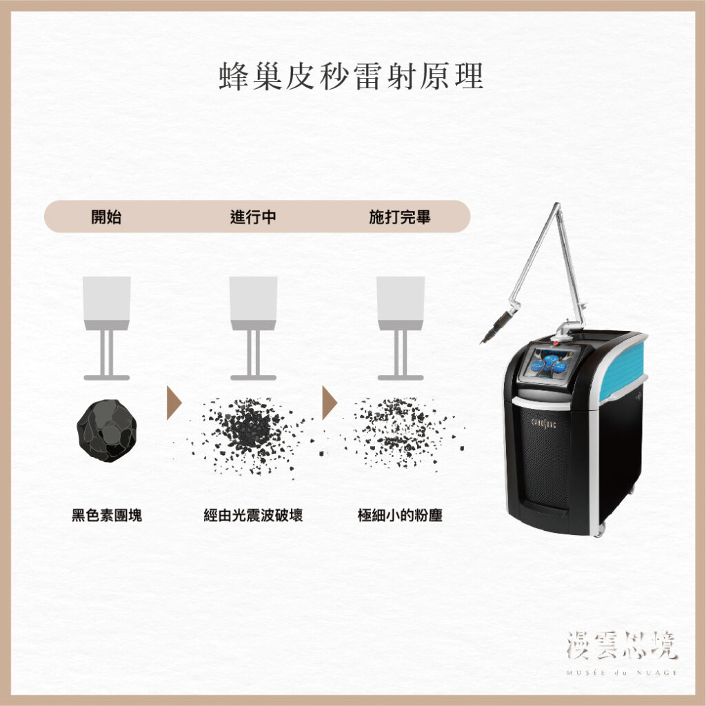 2025皮秒雷射攻略|輕鬆瞭解皮秒效果、原理、功效與常見問題 - MUSÉE du NUAGE 漫雲思境