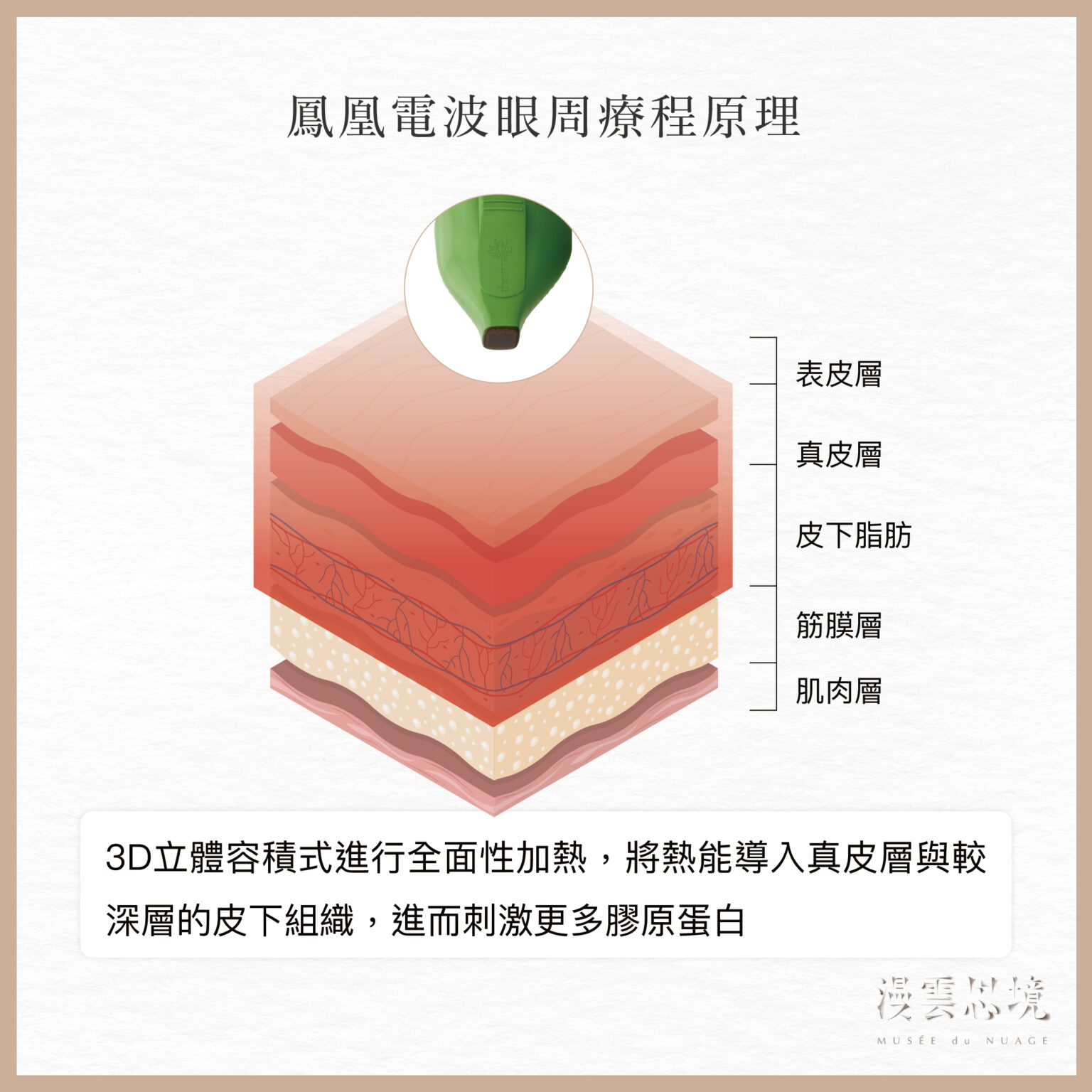 如何找回緊緻雙眸?認識眼周電波常見問題與鳳凰電波眼周療程原理 - MUSÉE du NUAGE 漫雲思境