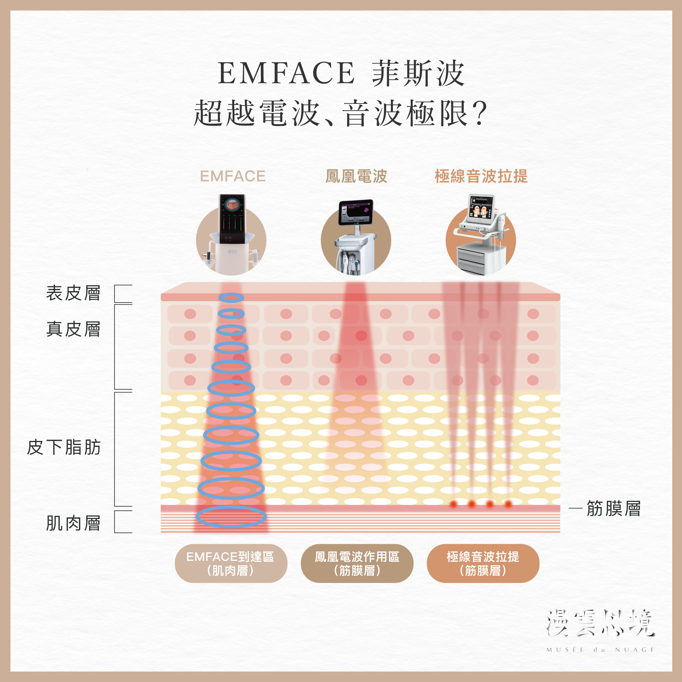 EMFACE菲斯波跟鳳凰電波、音波差在哪？