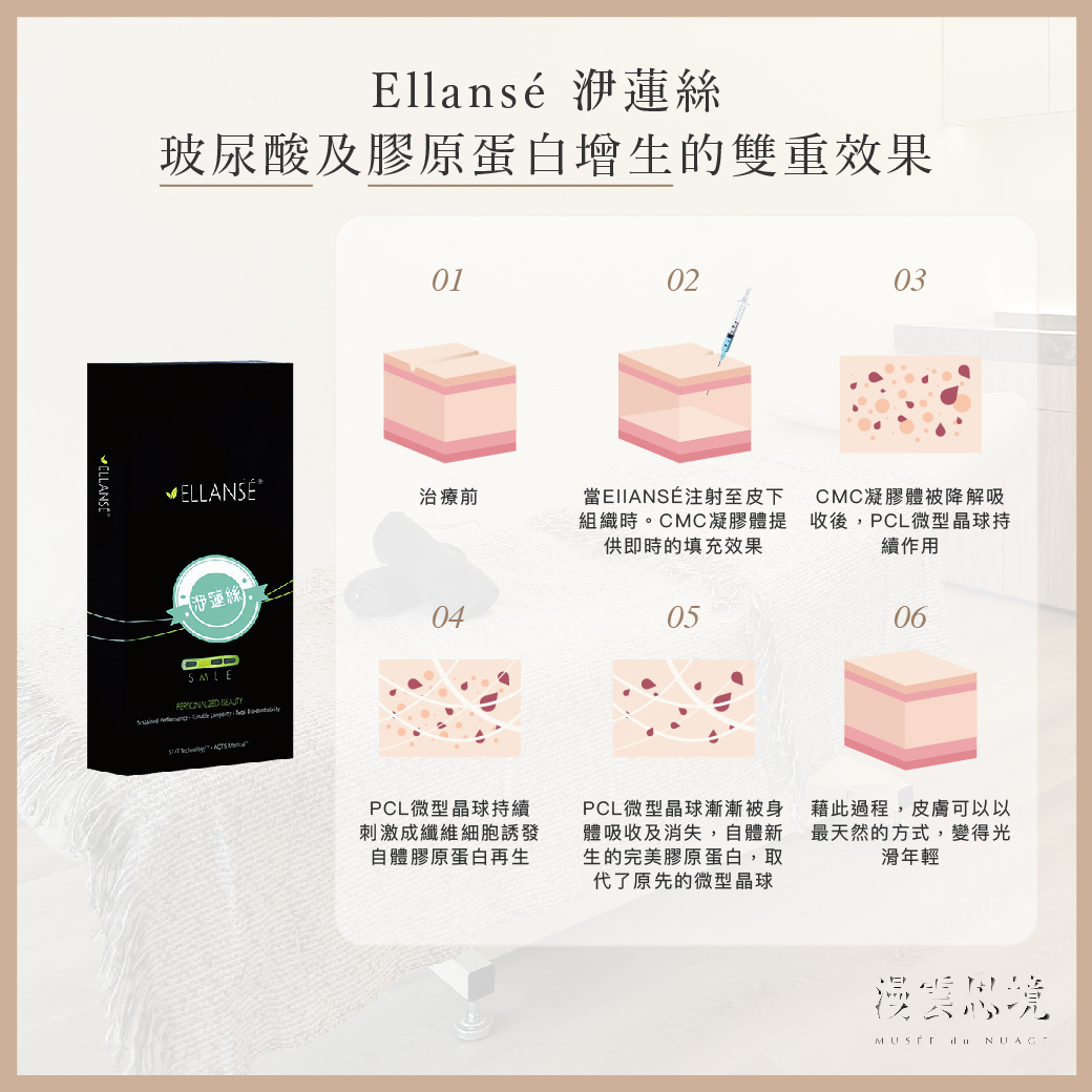 膠原蛋白增生劑2：洢蓮絲 Ellansé 