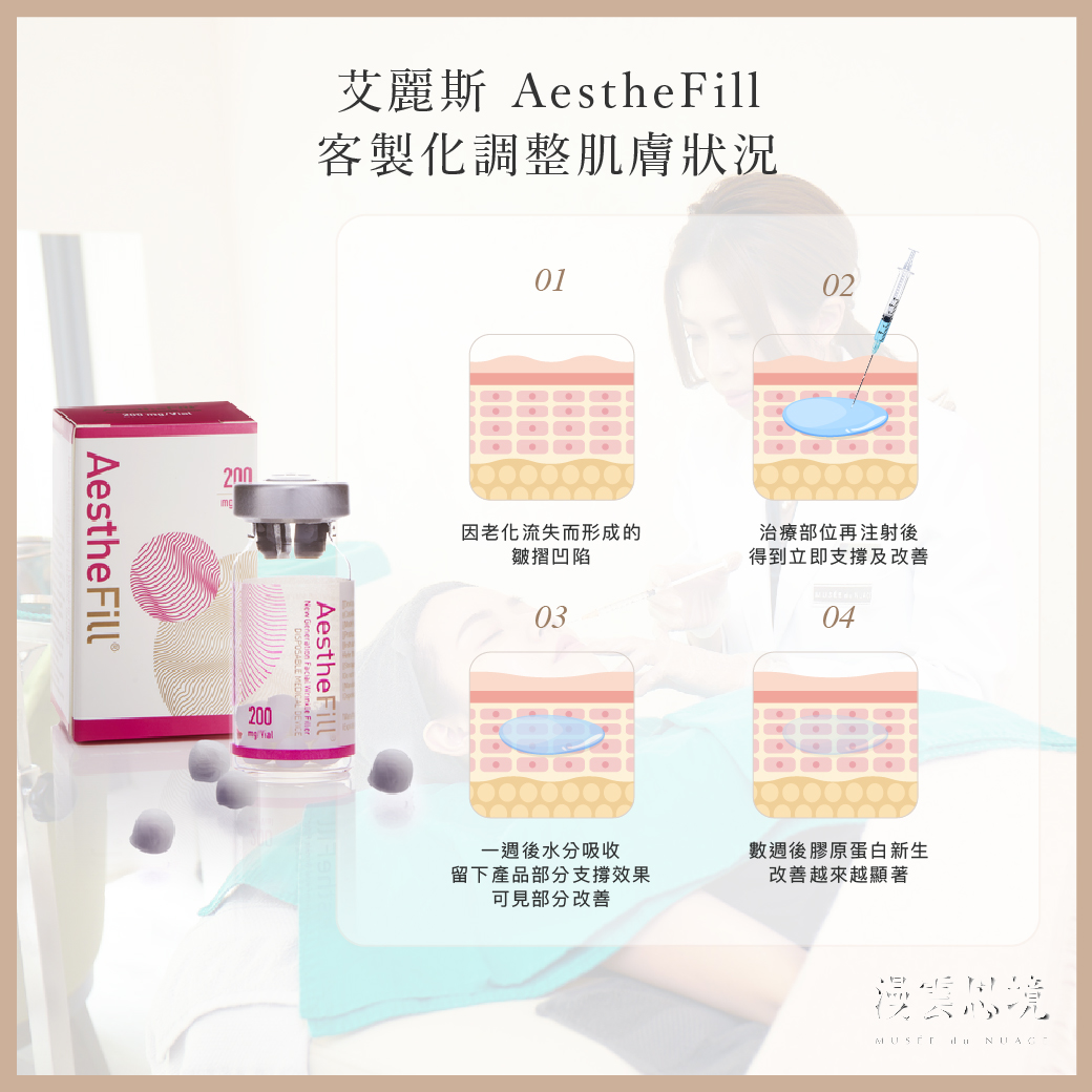 膠原蛋白增生劑3：艾麗斯 AestheFill 