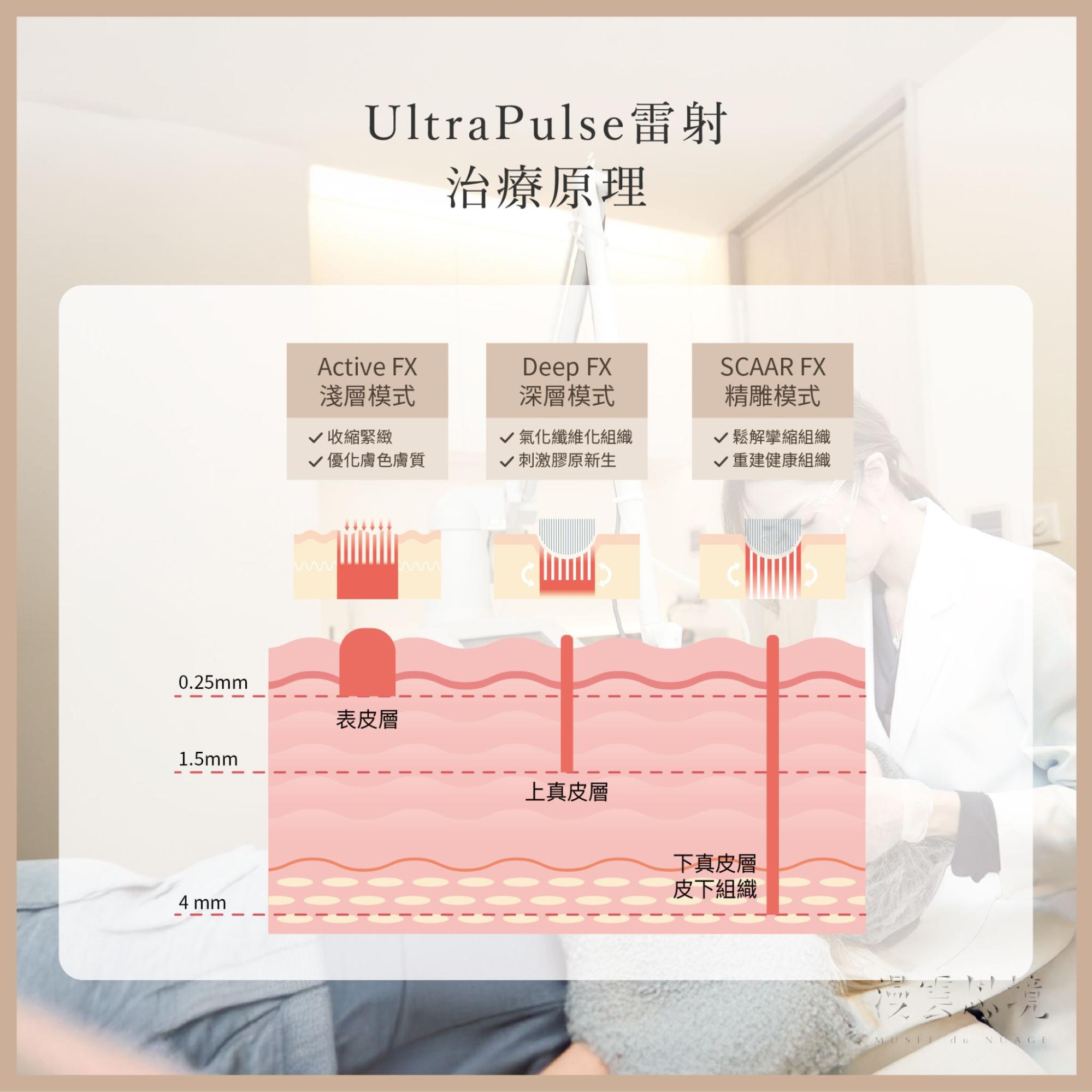 UltraPulse雷射
