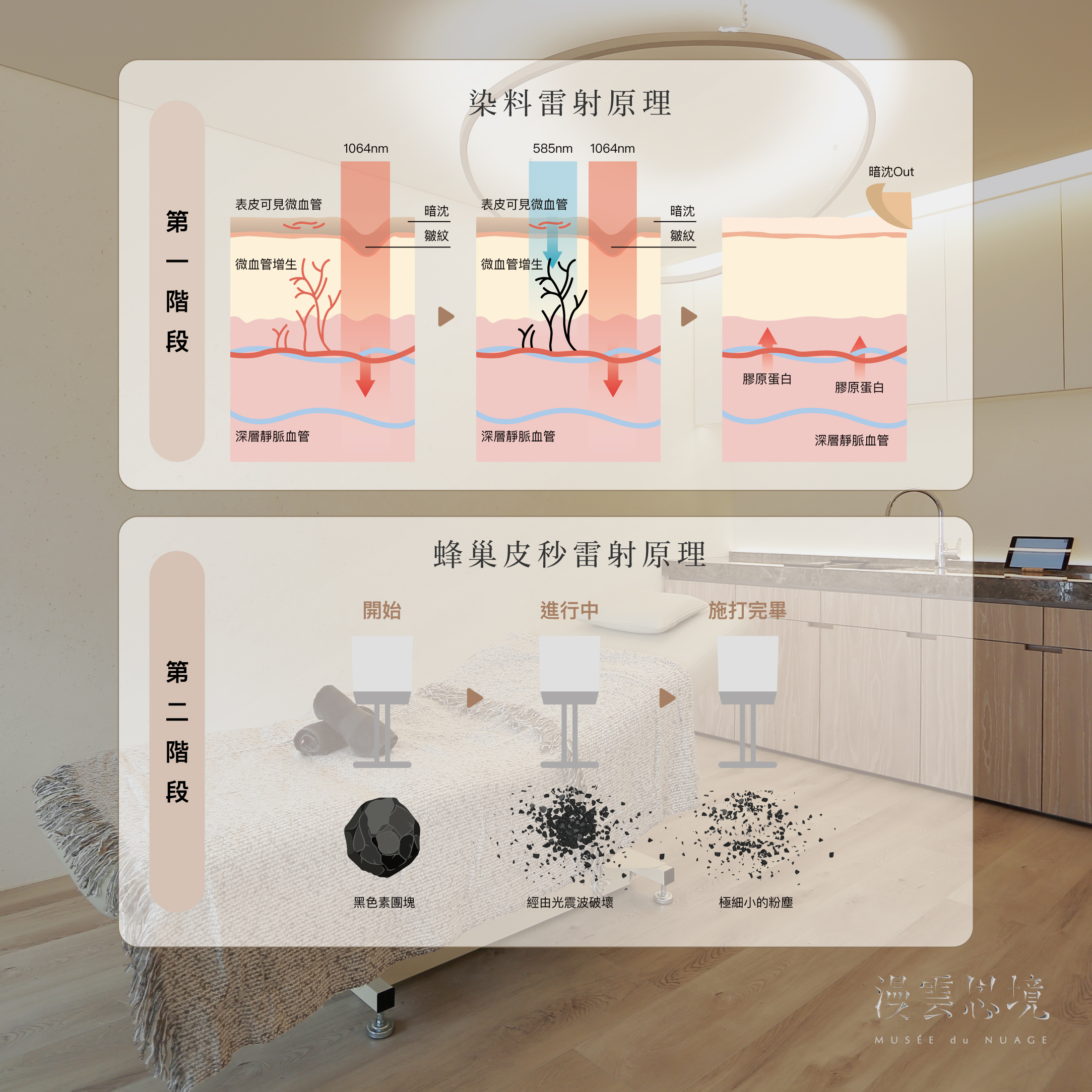 染料雷射、蜂巢皮秒治療原理