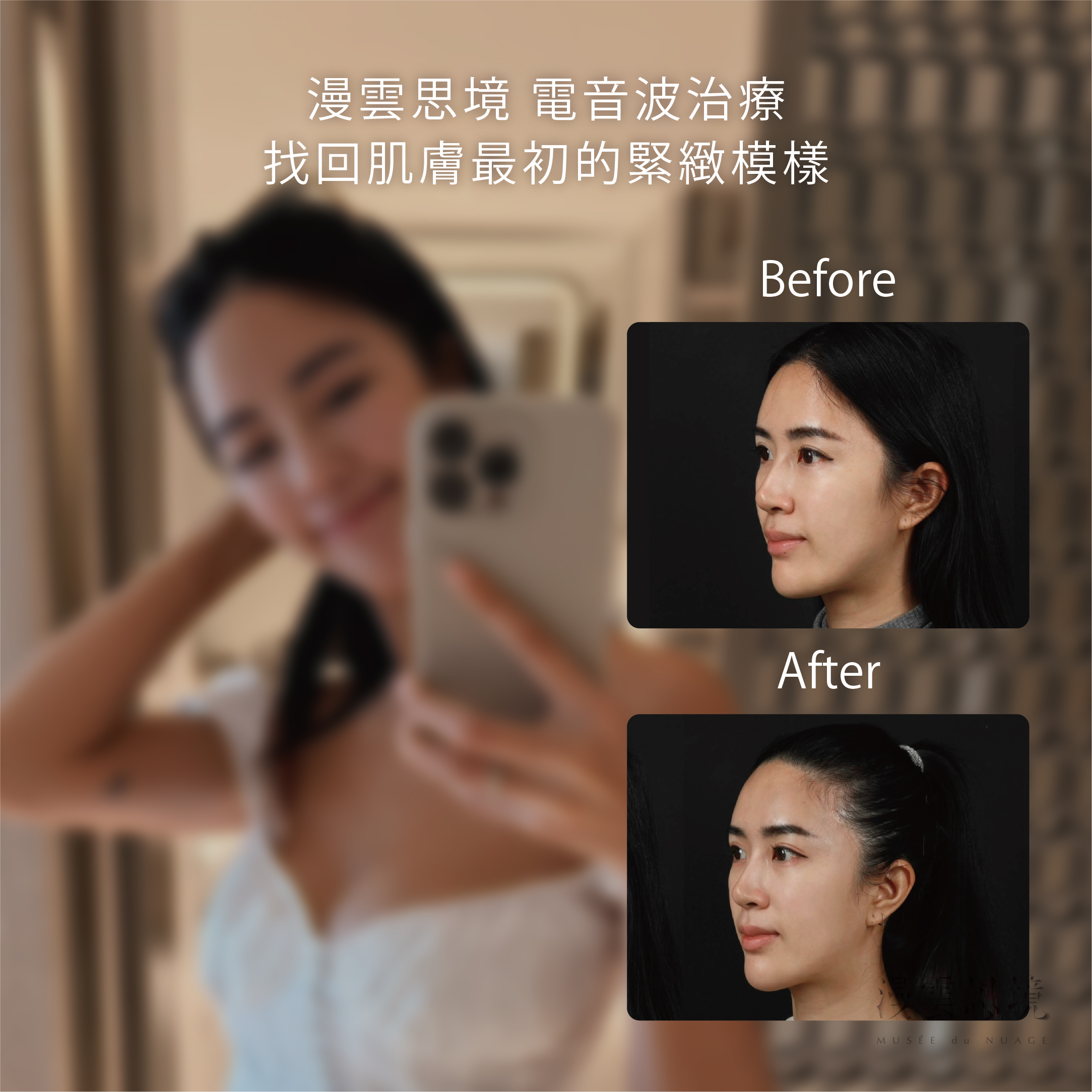 電音波治療，找回肌膚最緊緻的模樣