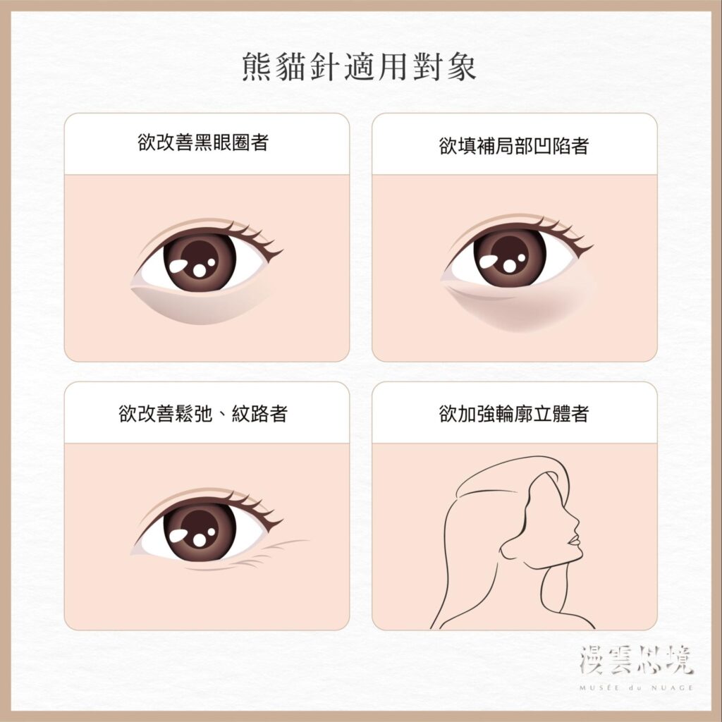 熊貓針的適用對象有哪些？